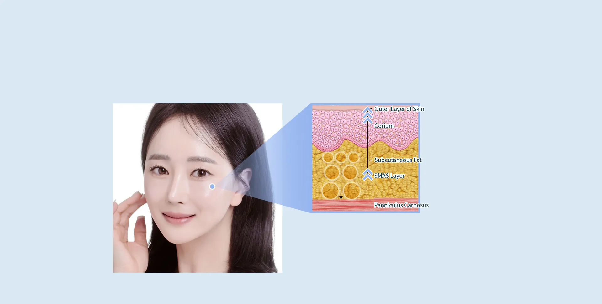 Fat Injection(Full face)